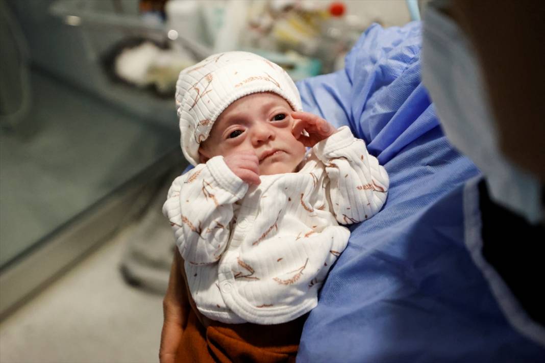 380 gram doğdu, defalarca kalbi durdu! Hira Su bebekten güzel haber 2